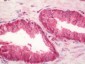 Anti-RPL3 / Ribosomal Protein L3 Antibody 